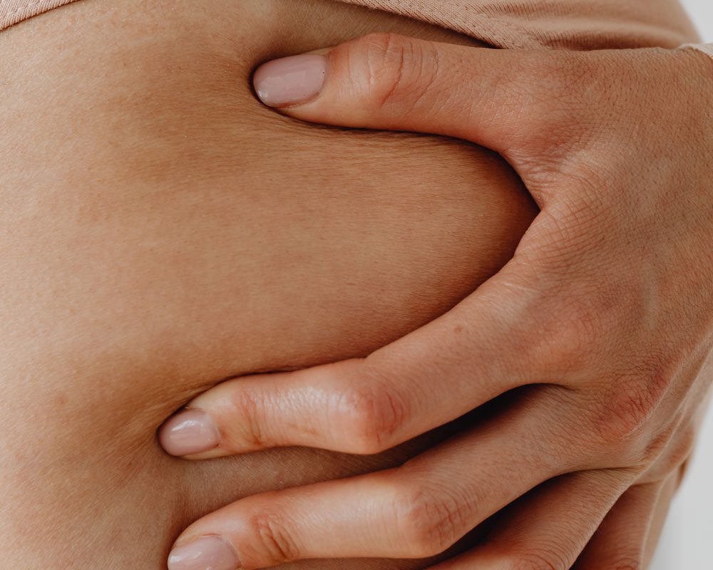 Celulitis